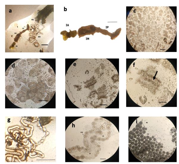 Aspecto del intestino de una larva de Monoctenus sp.